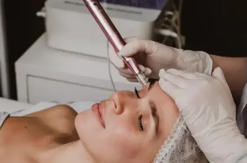 Does Microneedling Hurt?