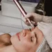 Does Microneedling Hurt?