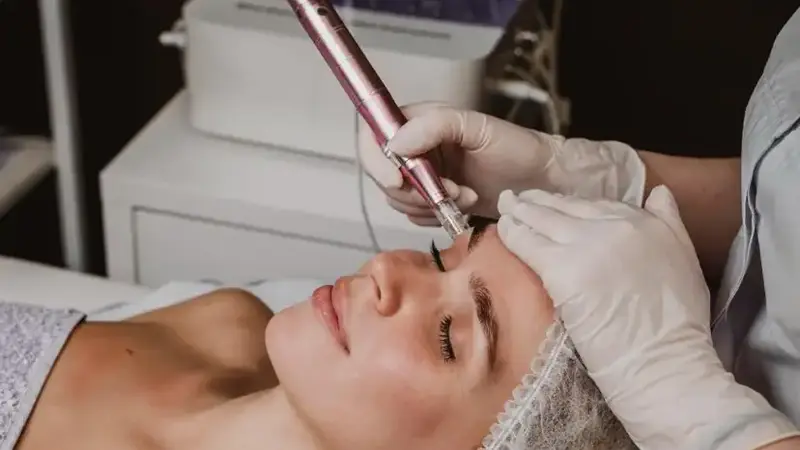 Does Microneedling Hurt?